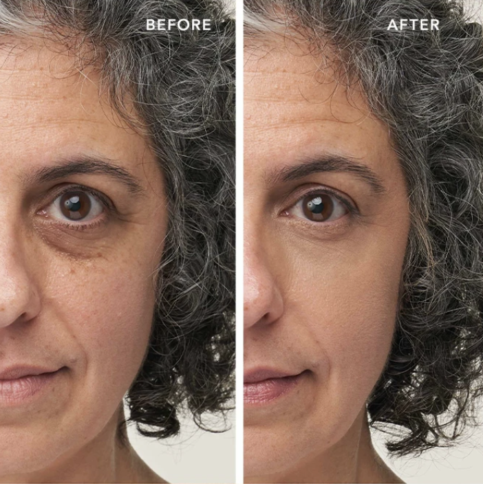 voor en na enlighten concealer makeup